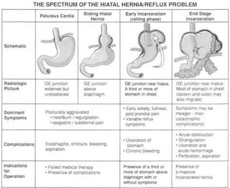 There is also confusion regarding the normal function of the gastroesophageal junction and the clinical implications of a hiatus hernia. . Hiatal hernia grade 3 treatment